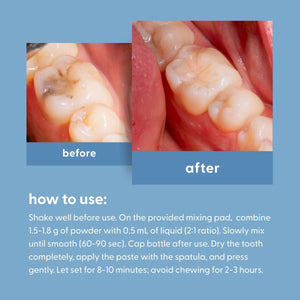 Dental Care Kit, Blue, 1ct