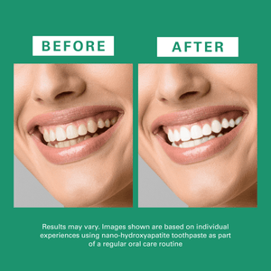 Hydroxyapatite w/Calcium Toothpaste, 4.23oz