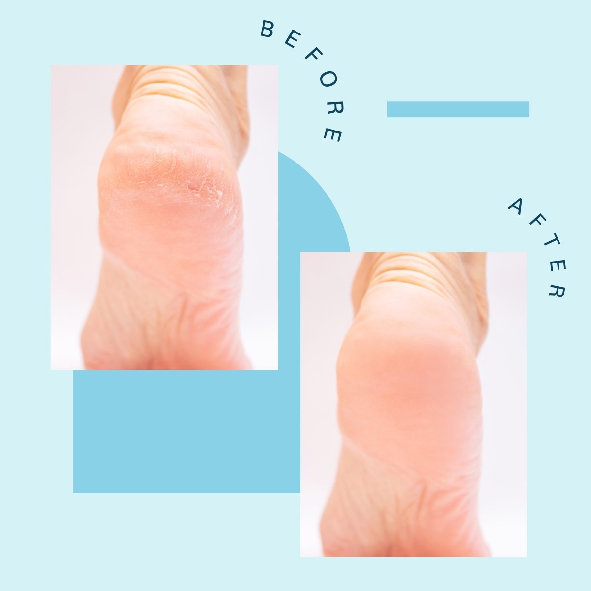 Foot Soak, Tea Tree Oil, 16oz