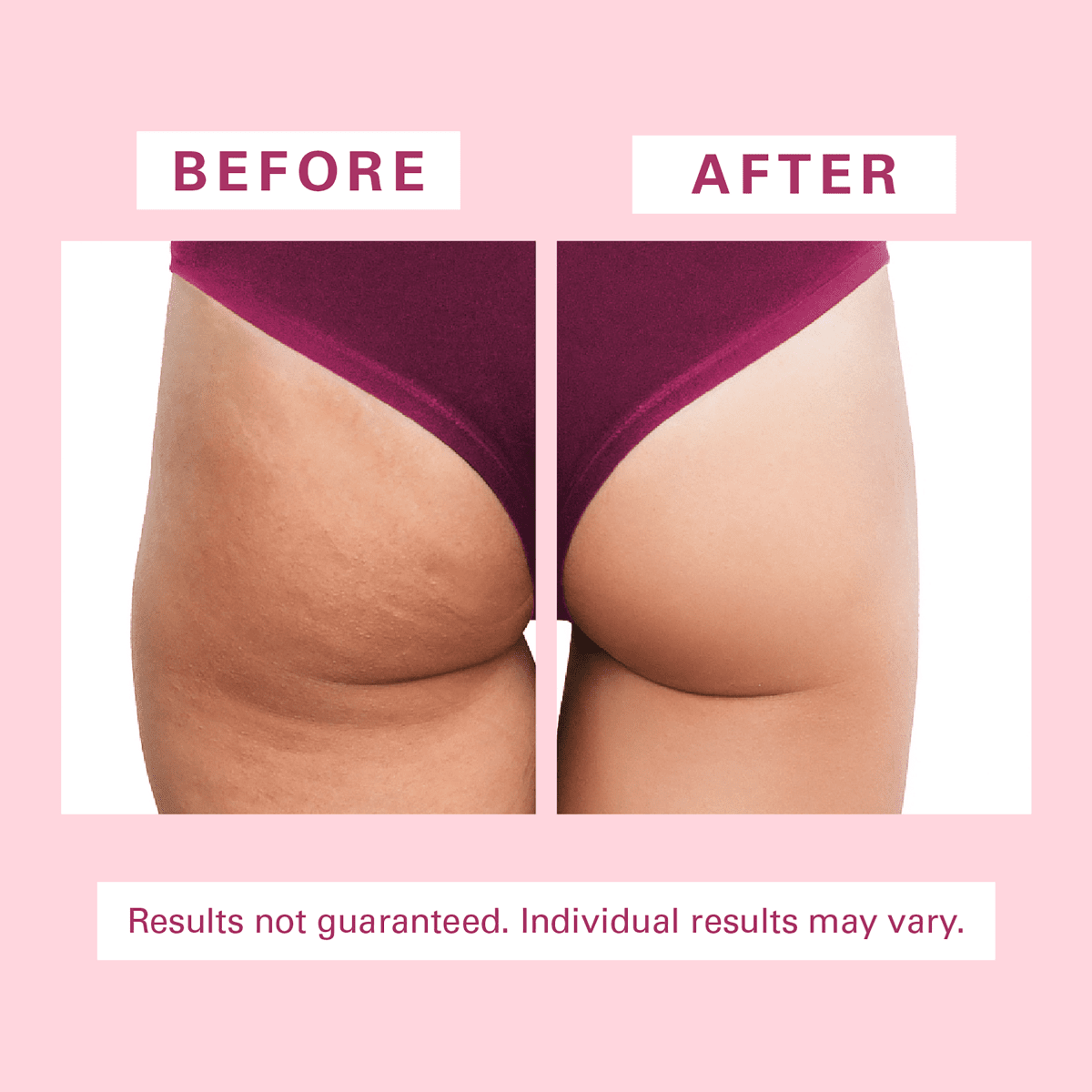 Cellulite Silicon Body Brush