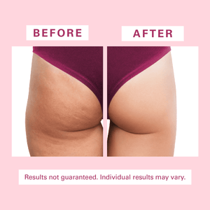 Cellulite Silicon Body Brush